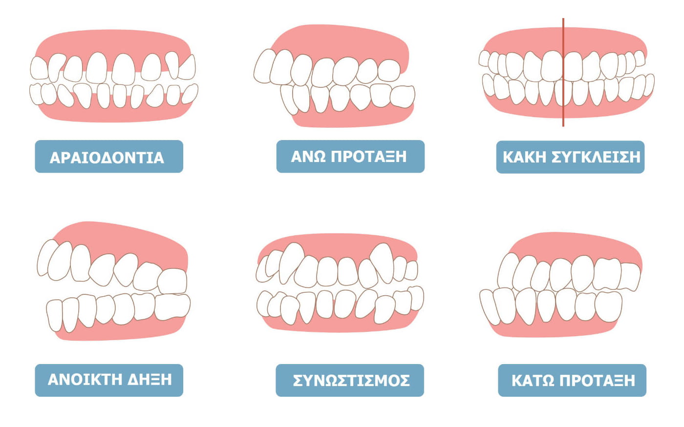 Invisalign θεραπείες ορθοδοντικής στην Κύπρο